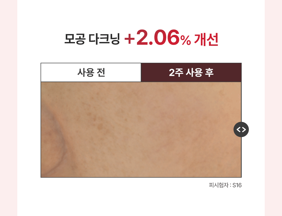 레드빈토너01