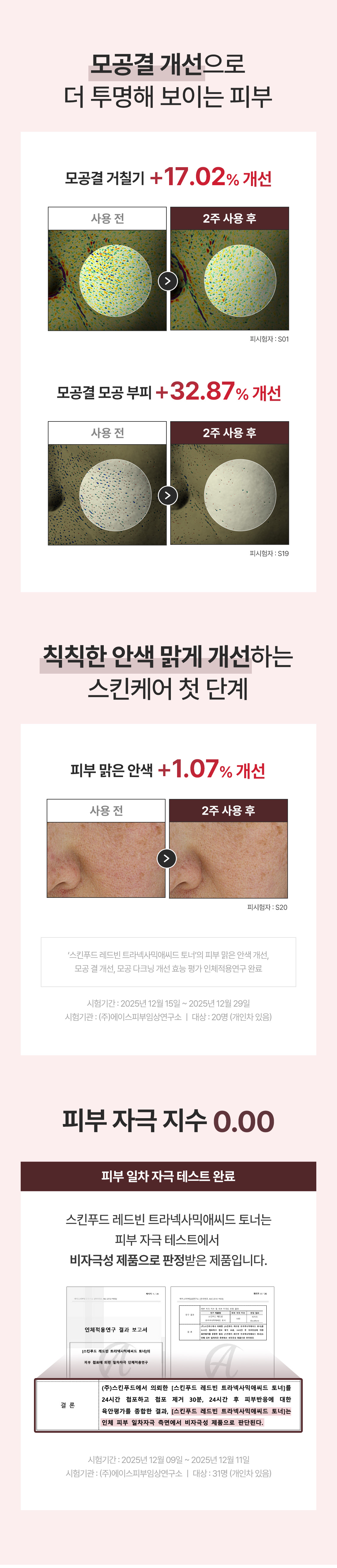 레드빈토너01